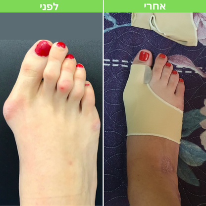 גרב הפלא לבוהן ולעצם הבולטת | מבית פומי ספורט