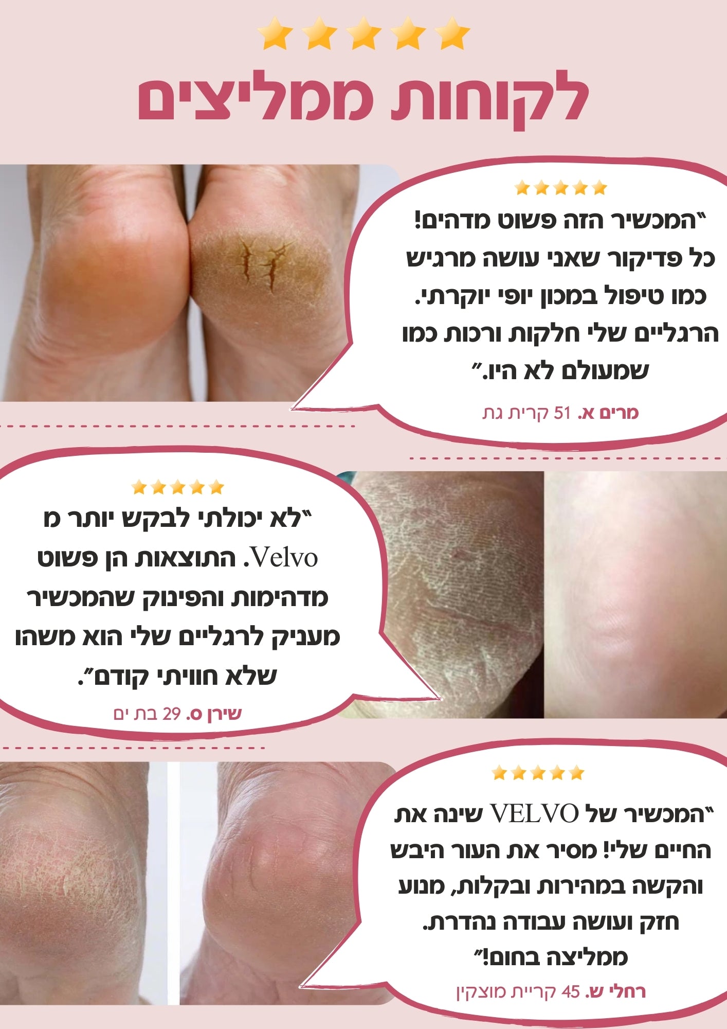 Velvo™ -  מכשיר פדיקור חשמלי מקצועי לשיוף והסרת עור יבש מכפות הרגליים