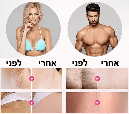 SilkX™  מכשיר לייזר ביתי להסרת שיער ללא כאב – 5 רמות להתאמה אישית מושלמת